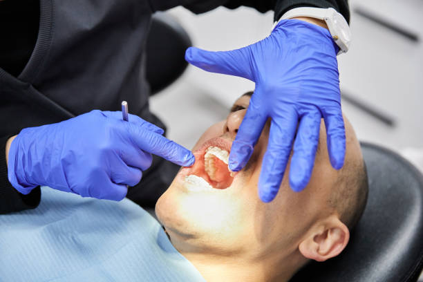 Best Emergency Dental Care for Sports Injuries in Homer, LA